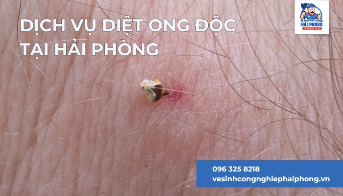 Dich-vu-diet-ong-doc